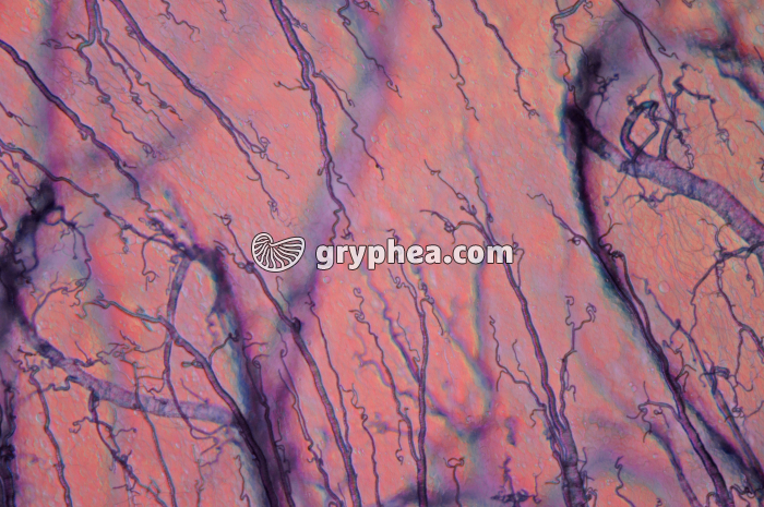 Trachées de Criquet (Locusta migratoria) x25 - gryphea.org